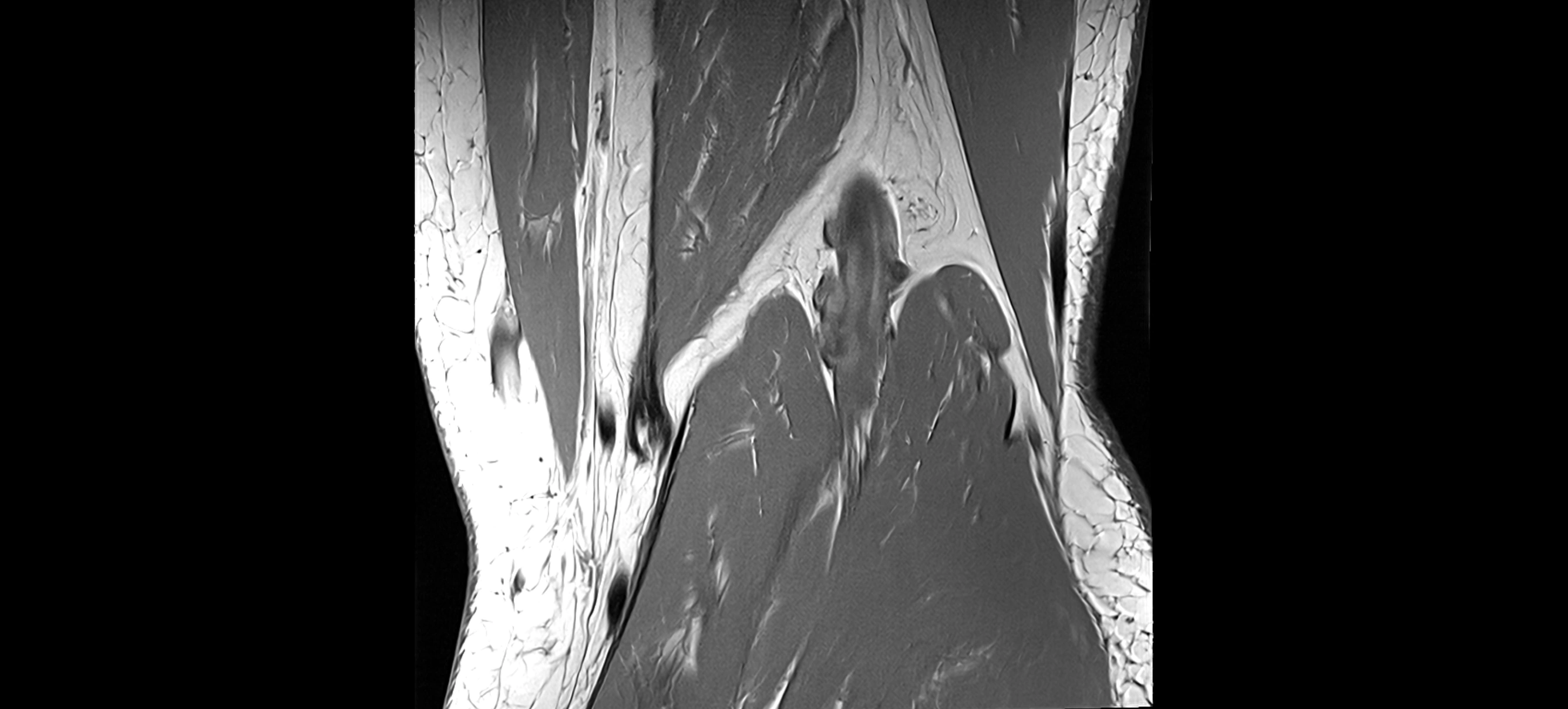 MRI coronal  ligaments cross sectional anatomy 3T  radiology  image-img-04001-00034.webp